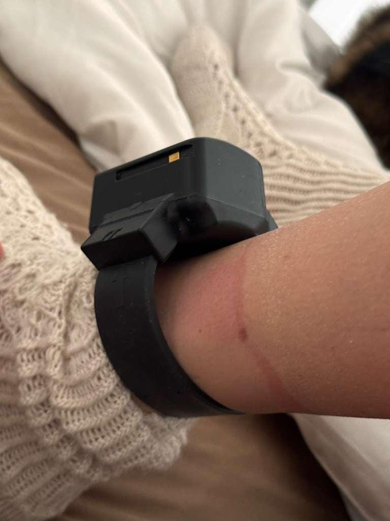 A black ankle monitor leaves a red mark and chaffing on a leg with a knitted sock on the foot